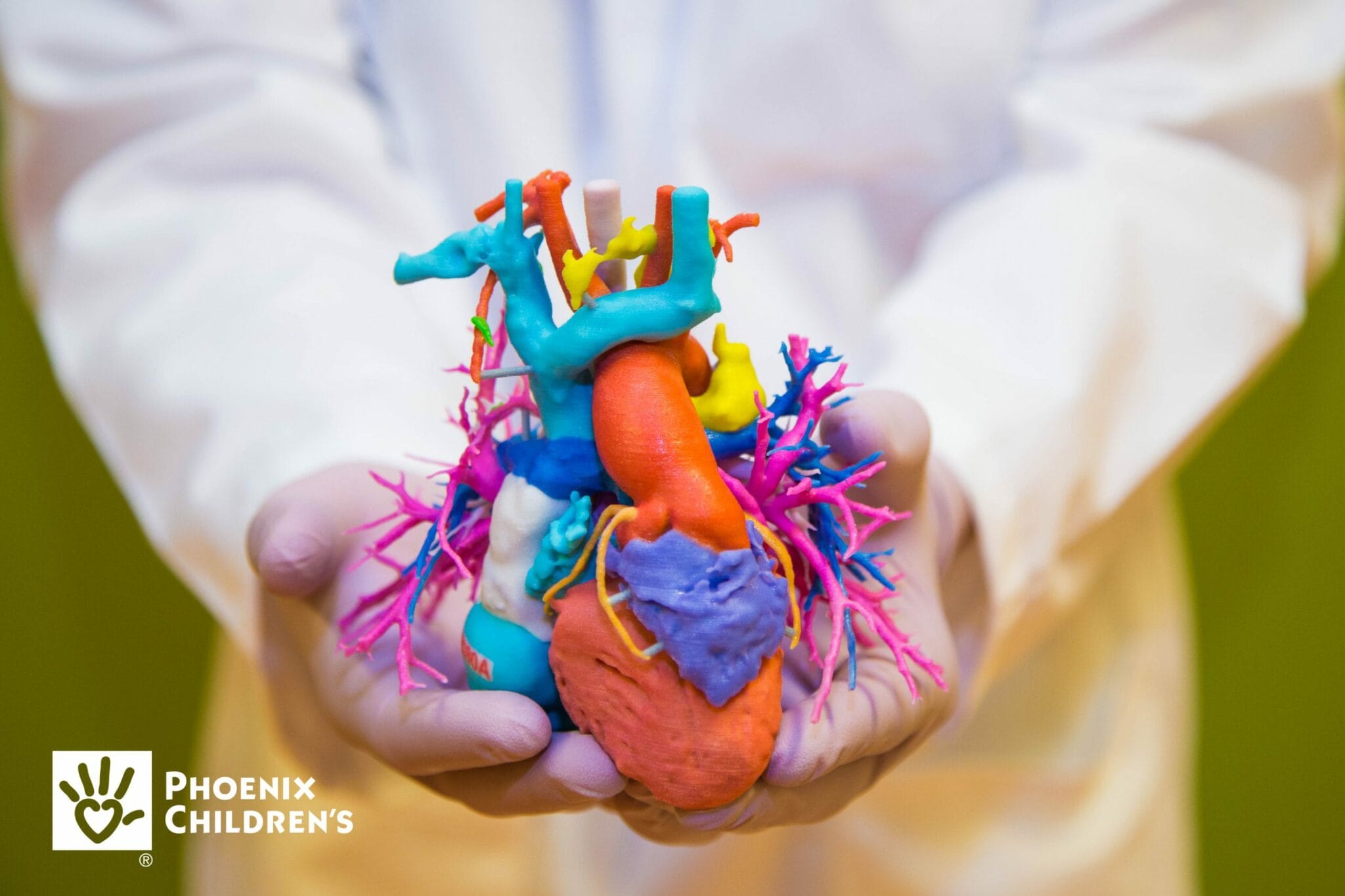 Phoenix Children's Hospital 3D printed heart model. (Image courtesy Phoenix Children's Hospital)